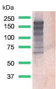 Western blot - Anti-EGFR (deleted E746 + L747 + R748 + E749 + A750) antibody [SP111] (AB227737)