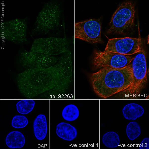 Immunocytochemistry/ Immunofluorescence - Anti-EGFR (mutated L858R) antibody [EPR15348] (AB192263)