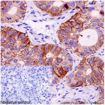 Immunohistochemistry (Formalin/PFA-fixed paraffin-embedded sections) - Anti-EGFR (mutated L858R) antibody [EPR15348] (AB192263)