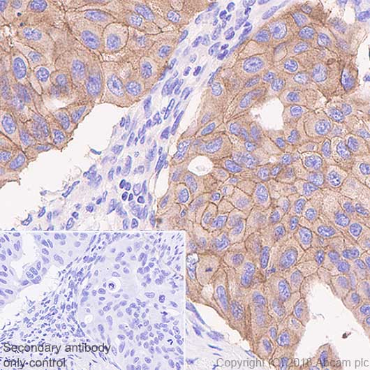 Immunohistochemistry (Formalin/PFA-fixed paraffin-embedded sections) - Anti-EGFR (mutated L858R) antibody [SP125] (AB227647)