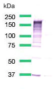 Western blot - Anti-EGFR (mutated L858R) antibody [SP125] (AB227647)