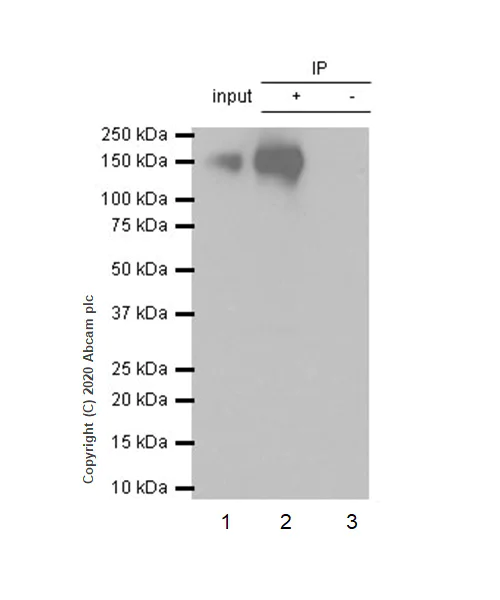 Immunoprecipitation - Anti-EGFR (phospho S1046 + S1047) antibody [EP2259Y] (AB76300)