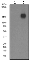 Western blot - Anti-EGFR (phospho S1046 + S1047) antibody [EP2259Y] (AB76300), expandable thumbnail