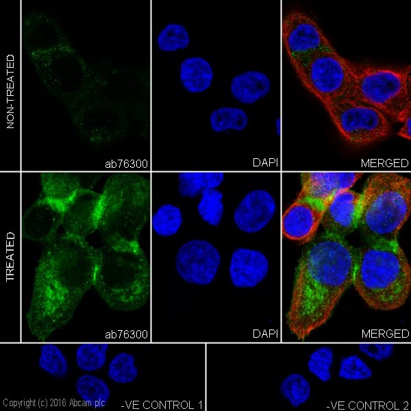 Immunocytochemistry/ Immunofluorescence - Anti-EGFR (phospho S1046 + S1047) antibody [EP2259Y] - BSA and Azide free (AB256225), expandable thumbnail