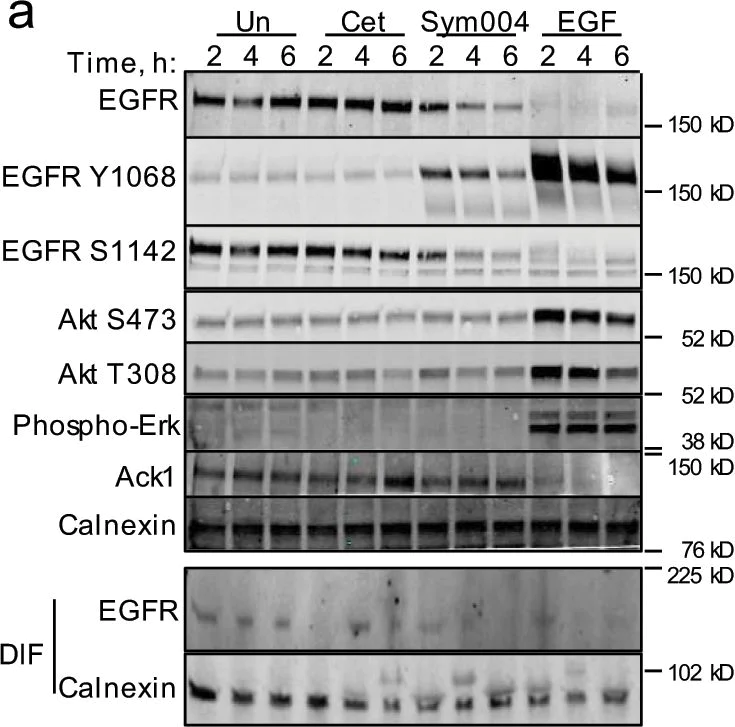 Western blot - Anti-EGFR (phospho S1142) antibody (AB76194)