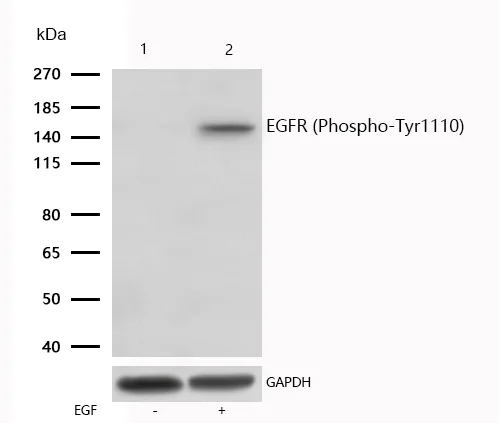 Western blot - Anti-EGFR (phospho S380) antibody [SR1196] (AB326650)