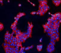 Immunocytochemistry/ Immunofluorescence - Anti-EGFR (phospho S671) antibody [EPR2257] (AB92629)