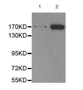 Western blot - Anti-EGFR (phospho T654) antibody (AB194733)