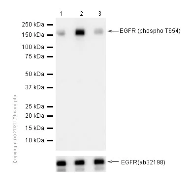 Western blot - Anti-EGFR (phospho T654) antibody [EP2255Y] - BSA and Azide free (AB284729)