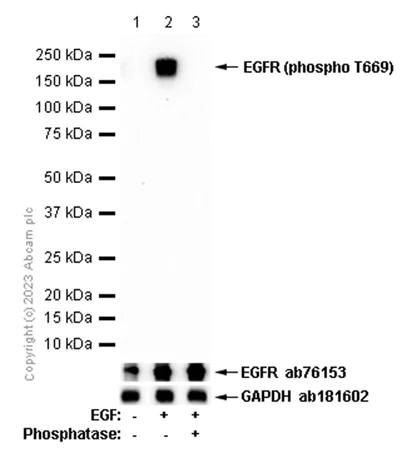Western blot - Anti-EGFR (phospho T669) antibody [EP2256Y] - BSA and Azide free (AB284728)