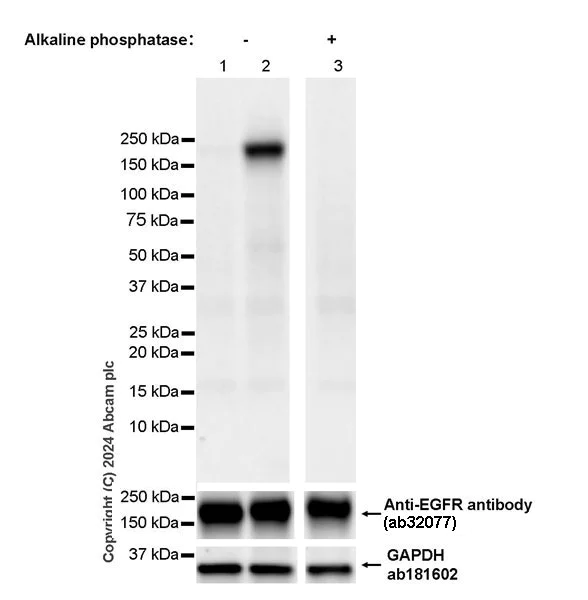 Western blot - Anti-EGFR (phospho Y1045) antibody [EPR28381-88] - BSA and Azide free (AB316156)