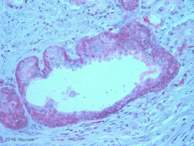Immunohistochemistry (Formalin/PFA-fixed paraffin-embedded sections) - Anti-EGFR (phospho Y1068) antibody [EP774Y] (AB40815)