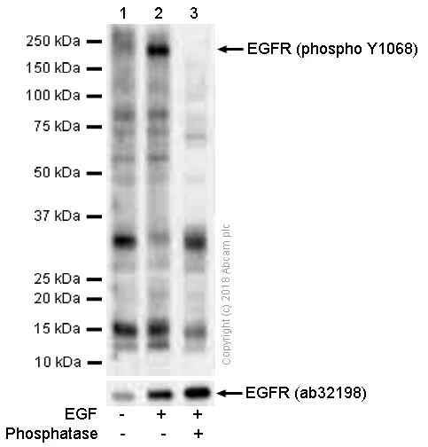 Western blot - Anti-EGFR (phospho Y1068) antibody [EP774Y] (AB40815)