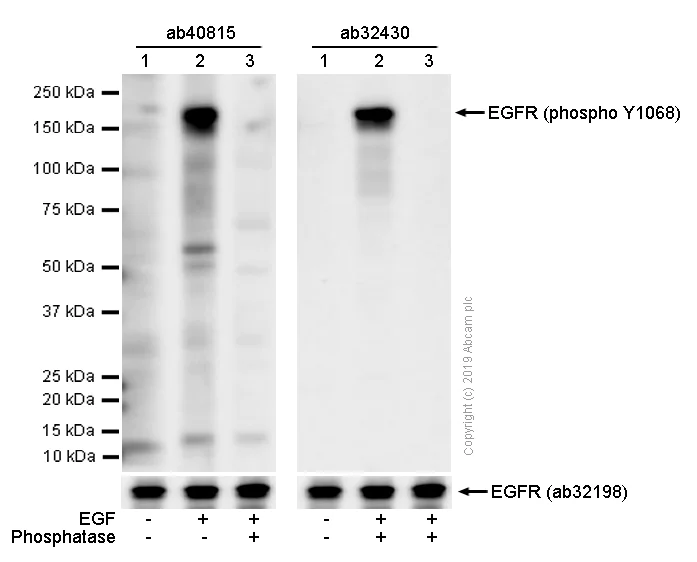 Western blot - Anti-EGFR (phospho Y1068) antibody [EP774Y] (AB40815)