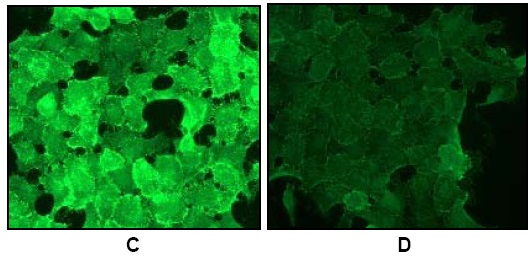 Immunocytochemistry/ Immunofluorescence - Anti-EGFR (phospho Y1068) antibody [EP774Y] - BSA and Azide free (ab182618), expandable thumbnail