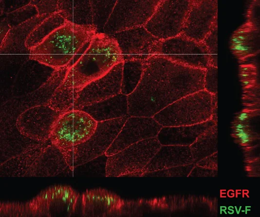 Immunocytochemistry/ Immunofluorescence - Anti-EGFR (phospho Y1068) antibody [EP774Y] - BSA and Azide free (AB182618)