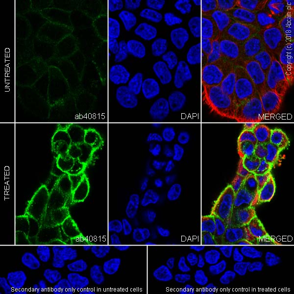 Immunocytochemistry/ Immunofluorescence - Anti-EGFR (phospho Y1068) antibody [EP774Y] - BSA and Azide free (ab182618), expandable thumbnail
