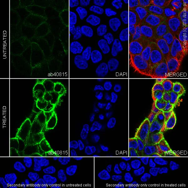 Immunocytochemistry/ Immunofluorescence - Anti-EGFR (phospho Y1068) antibody [EP774Y] - BSA and Azide free (AB182618)