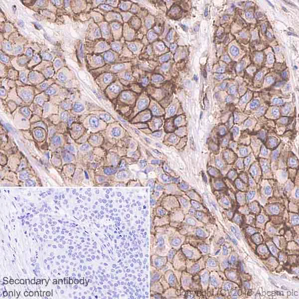 Immunohistochemistry (Formalin/PFA-fixed paraffin-embedded sections) - Anti-EGFR (phospho Y1068) antibody [EP774Y] - BSA and Azide free (AB182618)