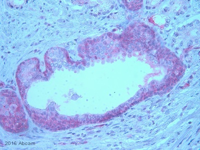 Immunohistochemistry (Formalin/PFA-fixed paraffin-embedded sections) - Anti-EGFR (phospho Y1068) antibody [EP774Y] - BSA and Azide free (AB182618), expandable thumbnail