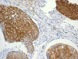 Immunohistochemistry (Formalin/PFA-fixed paraffin-embedded sections) - Anti-EGFR (phospho Y1068) antibody [EP774Y] - BSA and Azide free (AB182618)