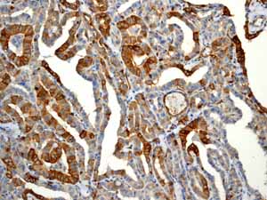 Immunohistochemistry (Formalin/PFA-fixed paraffin-embedded sections) - Anti-EGFR (phospho Y1068) antibody [EP774Y] - BSA and Azide free (ab182618), expandable thumbnail