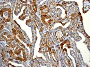Immunohistochemistry (Formalin/PFA-fixed paraffin-embedded sections) - Anti-EGFR (phospho Y1068) antibody [EP774Y] - BSA and Azide free (AB182618)