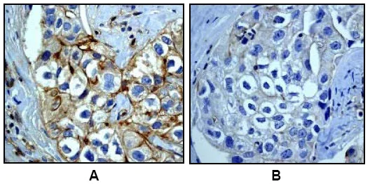 Immunohistochemistry (Formalin/PFA-fixed paraffin-embedded sections) - Anti-EGFR (phospho Y1068) antibody [EP774Y] - BSA and Azide free (AB182618)