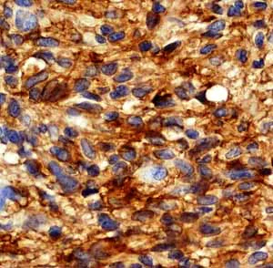 Immunohistochemistry (Formalin/PFA-fixed paraffin-embedded sections) - Anti-EGFR (phospho Y1068) antibody [EP774Y] - BSA and Azide free (AB182618)