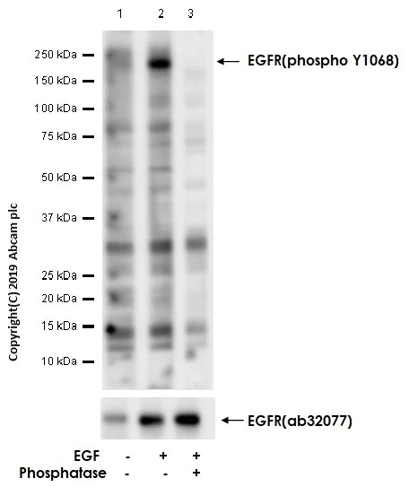 Western blot - Anti-EGFR (phospho Y1068) antibody [EP774Y] - BSA and Azide free (AB182618)