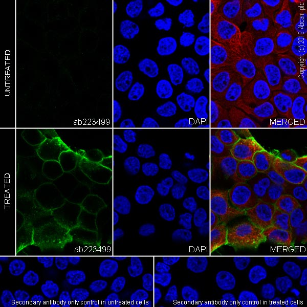 Immunocytochemistry/ Immunofluorescence - Anti-EGFR (phospho Y1068) antibody [SP353] (AB223499), expandable thumbnail