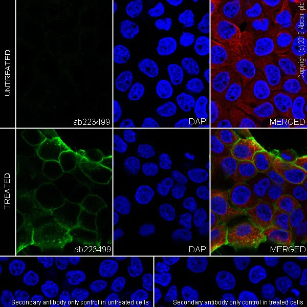 Immunocytochemistry/ Immunofluorescence - Anti-EGFR (phospho Y1068) antibody [SP353] (AB223499)