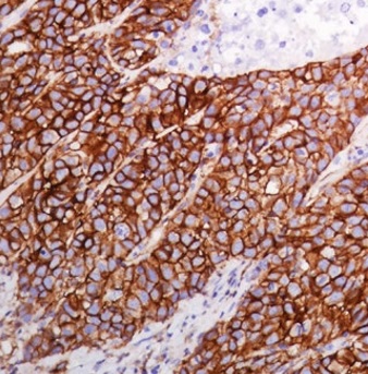 Immunohistochemistry (Formalin/PFA-fixed paraffin-embedded sections) - Anti-EGFR (phospho Y1068) antibody [SP353] (AB223499), expandable thumbnail