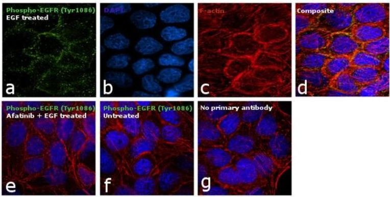 Immunocytochemistry - Anti-EGFR (phospho Y1086) antibody (AB5650)
