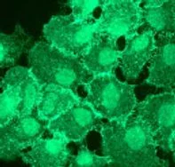 Immunocytochemistry/ Immunofluorescence - Anti-EGFR (phospho Y1086) antibody [EP2258IHCY] - BSA and Azide free (AB247385)