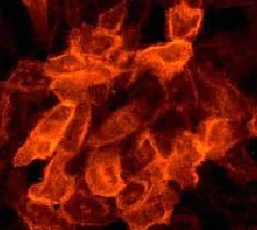 Immunocytochemistry/ Immunofluorescence - Anti-EGFR (phospho Y1086) antibody [Y39] - BSA and Azide free (AB247225)