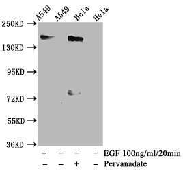 Western blot - Anti-EGFR (phospho Y1092)  antibody [3H9] (AB314030), expandable thumbnail