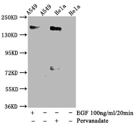 Western blot - Anti-EGFR (phospho Y1092) antibody [3H9] (AB314030)