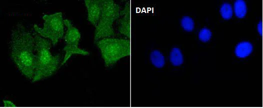 Immunocytochemistry/ Immunofluorescence - Anti-EGFR (phospho Y1092) antibody [SJ0194] (AB326619)