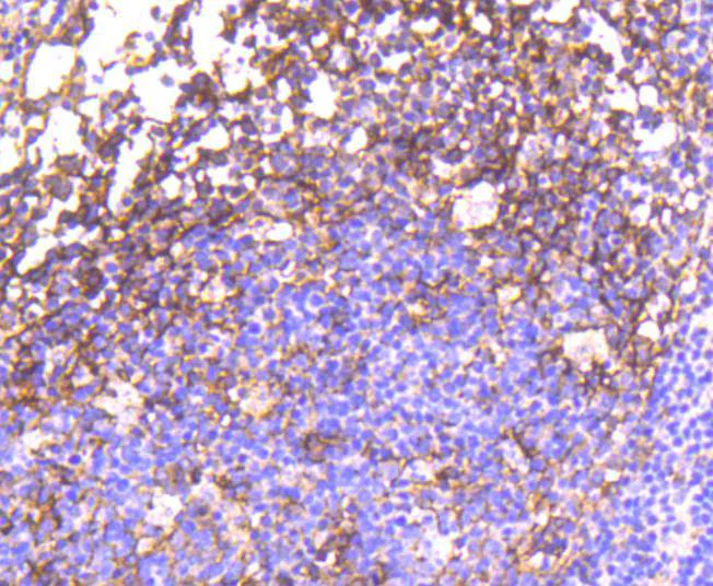Immunohistochemistry (Formalin/PFA-fixed paraffin-embedded sections) - Anti-EGFR (phospho Y1092) antibody [SJ0194] (AB326619)