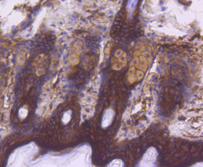 Immunohistochemistry (Formalin/PFA-fixed paraffin-embedded sections) - Anti-EGFR (phospho Y1092) antibody [SJ0194] (AB326619)