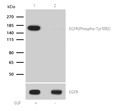 Western blot - Anti-EGFR (phospho Y1092) antibody [SJ0194] (AB326619)