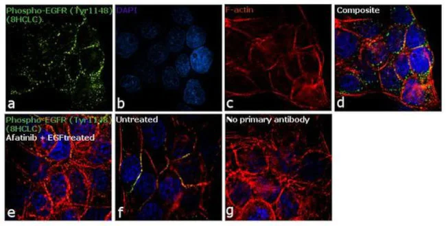 Immunocytochemistry/ Immunofluorescence - Anti-EGFR (phospho Y1148) antibody [RP23040050] (AB307989)