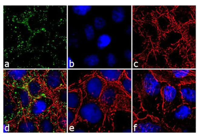 Immunocytochemistry/ Immunofluorescence - Anti-EGFR (phospho Y1148) antibody [RP23040050] (AB307989)