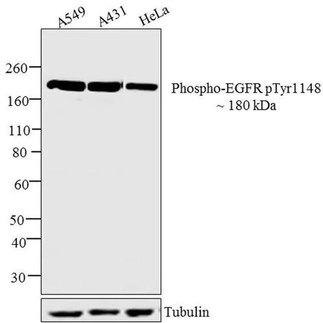 Western blot - Anti-EGFR (phospho Y1148) antibody [RP23040050] (AB307989)