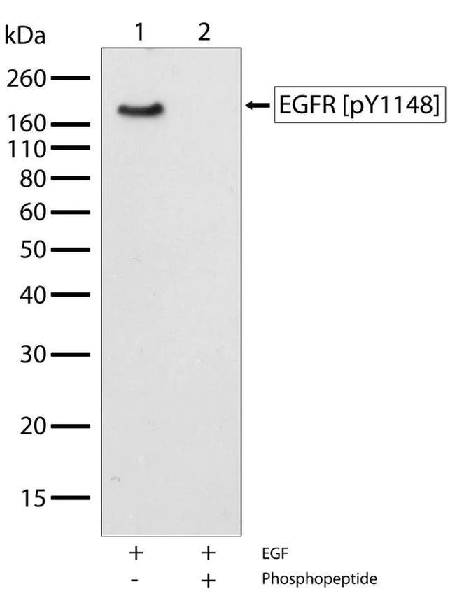 Western blot - Anti-EGFR (phospho Y1148) antibody [RP23040050] (AB307989)