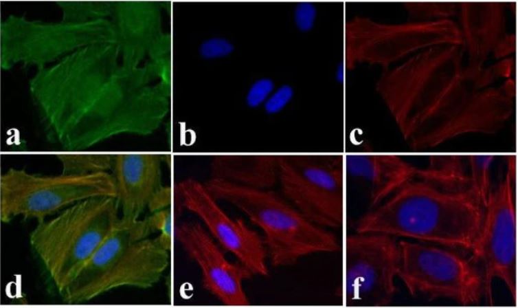 Immunocytochemistry - Anti-EGFR (phospho Y1173) antibody (AB5652)