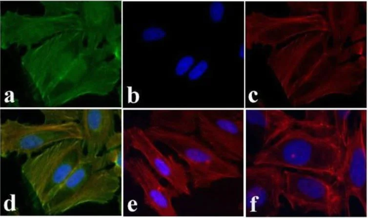 Immunocytochemistry - Anti-EGFR (phospho Y1173) antibody (AB5652)