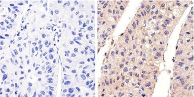 Immunohistochemistry (Formalin/PFA-fixed paraffin-embedded sections) - Anti-EGFR (phospho Y1173) antibody (AB5652)