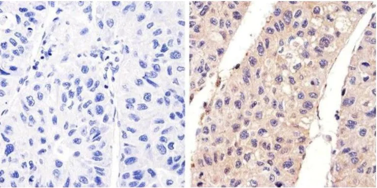 Immunohistochemistry (Formalin/PFA-fixed paraffin-embedded sections) - Anti-EGFR (phospho Y1173) antibody (AB5652)